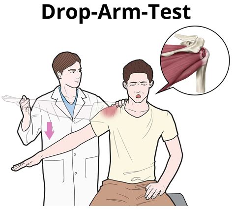 better to do drop arm test seated or standing|shoulder drop arm test.